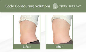 Now Offering! Two Non-Invasive Body Contouring Solutions