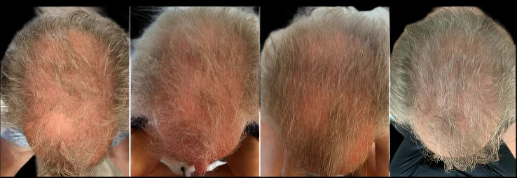 Celluma Restore