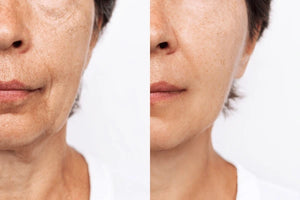 Cryo Anti-Aging Facial